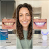 BrightSmile Teeth Whitening Kit